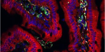 Immunology of Barrier Surfaces